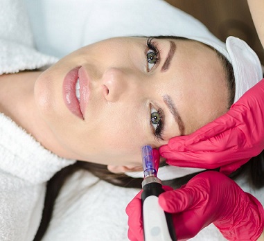 Microneedling